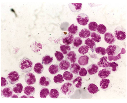 Corantes Microscopia Corante de Leishman Corantes  vitrilab