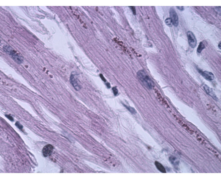 Corantes Microscopia Fucsina Fenica Ziehl-Neelsen Corantes  vitrilab