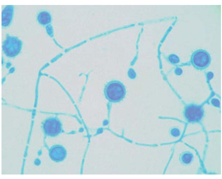 Corantes Microscopia Lactofenol Azul id5621 Liquidos  vitrilab